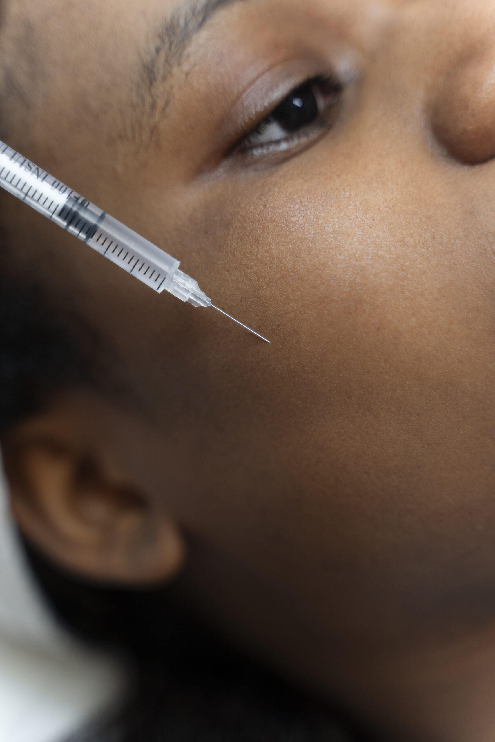 Bioestimulação de Colágeno